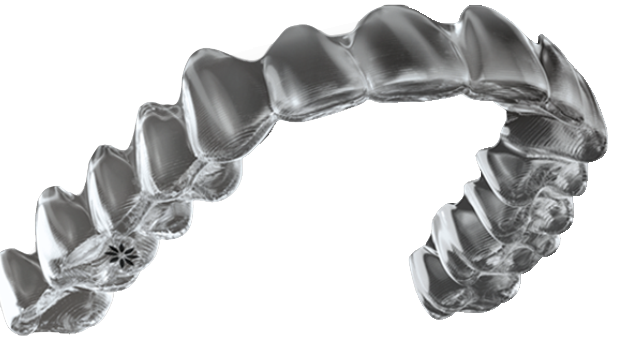 Seattle Invisalign Dentist